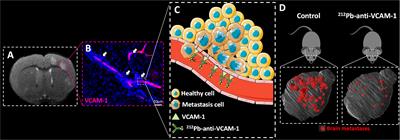 Radioimmunotherapy for Brain Metastases: The Potential for Inflammation as a Target of Choice